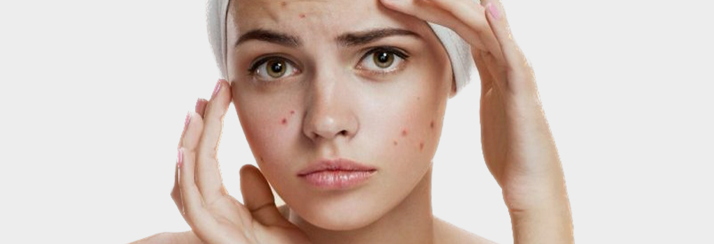acne extraction Bangkok